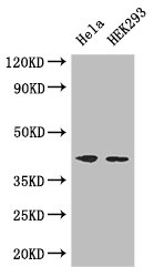 ACTG1 / Gamma Actin Antibody - Positive WB detected in:Hela whole cell lysate,HEK293 whole cell lysate;All lanes: ACTG1 antibody at 3ug/ml;Secondary;Goat polyclonal to rabbit IgG at 1/50000 dilution;Predicted band size: 42 kDa;Observed band size: 42 kDa;