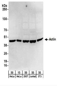 ACTG1 / Gamma Actin Antibody - Detection of Human and Mouse Actin by Western Blot. Samples: Whole cell lysate from HeLa (15 and 50 ug), 293T (50 ug), Jurkat (50 ug), and mouse NIH3T3 (50 ug) cells. Antibodies: Affinity purified rabbit anti-Actin antibody used for WB at 0.1 ug/ml. Detection: Chemiluminescence with an exposure time of 30 seconds.