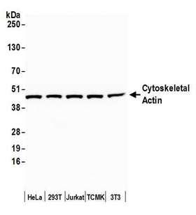 ACTG1 / Gamma Actin Antibody - Detection of human and mouse Cytoskeletal Actin by western blot. Samples: Whole cell lysate (15 µg) from HeLa, HEK293T, Jurkat, mouse TCMK-1, and mouse NIH 3T3 cells prepared using NETN lysis buffer. Antibody: Affinity purified rabbit anti-Cytoskeletal Actin antibody used for WB at 0.1 µg/ml. Detection: Chemiluminescence with an exposure time of 10 seconds.