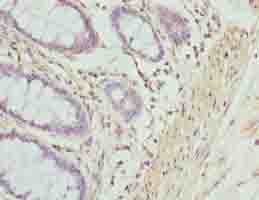 ACTG2 Antibody - Immunohistochemistry of paraffin-embedded human rectum tissue using antibody at dilution of 1:100.