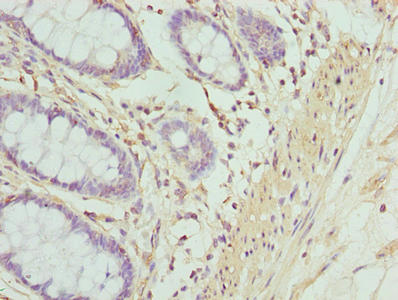 ACTG2 Antibody - Immunohistochemistry of paraffin-embedded human rectum tissue using ACTG2 Antibody at dilution of 1:100