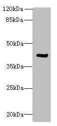ACTG2 Antibody - Western blot All lanes: ACTG2 antibody at 3µg/ml + CEM whole cell lysate Secondary Goat polyclonal to rabbit IgG at 1/10000 dilution Predicted band size: 42, 38 kDa Observed band size: 42 kDa