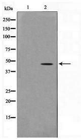 ACTG2 Antibody - Western blot of COLO205 cell lysate using Actin-gamma2 Antibody