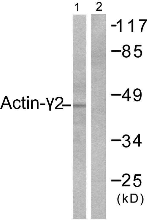 ACTG2 Antibody - Western blot analysis of extracts from COLO205 cells, using Actin-?2 antibody.