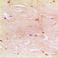 ACTG2 Antibody - Immunohistochemical analysis of Alpha-actin-3 staining in human muscle formalin fixed paraffin embedded tissue section. The section was pre-treated using heat mediated antigen retrieval with sodium citrate buffer (pH 6.0). The section was then incubated with the antibody at room temperature and detected using an HRP conjugated compact polymer system. DAB was used as the chromogen. The section was then counterstained with hematoxylin and mounted with DPX.