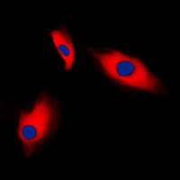 ACTG2 Antibody - Immunofluorescent analysis of Alpha-actin-3 staining in HeLa cells. Formalin-fixed cells were permeabilized with 0.1% Triton X-100 in TBS for 5-10 minutes and blocked with 3% BSA-PBS for 30 minutes at room temperature. Cells were probed with the primary antibody in 3% BSA-PBS and incubated overnight at 4 C in a humidified chamber. Cells were washed with PBST and incubated with a DyLight 594-conjugated secondary antibody (red) in PBS at room temperature in the dark. DAPI was used to stain the cell nuclei (blue).