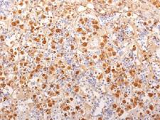 ACTH Antibody - IHC testing of FFPE human pituitary gland with ACTH antibody (clone 2F6) This image was taken for the unmodified form of this product. Other forms have not been tested.