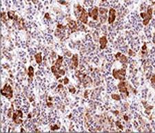 ACTH Antibody - ACTH antibody AH26 immunohistochemistry pituitary gland.  This image was taken for the unmodified form of this product. Other forms have not been tested.