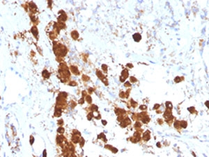ACTH Antibody - IHC testing of FFPE human pituitary gland with anti-ACTH antibody (clone SPM333). This image was taken for the unmodified form of this product. Other forms have not been tested.