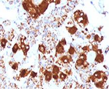 ACTH Antibody -  This image was taken for the unmodified form of this product. Other forms have not been tested.