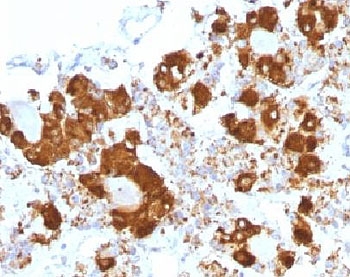 ACTH Antibody - IHC testing of FFPE human pituitary gland with ACTH antibody (clone CLIP/1407). Required HIER: steam sections in 10mM citrate buffer, pH6, for 10-20 min.