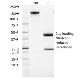 ACTH Antibody - SDS-PAGE Analysis of Purified, BSA-Free ACTH Antibody (clone CLIP/1407). Confirmation of Integrity and Purity of the Antibody.