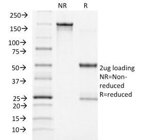 ACTH Antibody - SDS-PAGE Analysis of Purified, BSA-Free ACTH Antibody (clone CLIP/1418). Confirmation of Integrity and Purity of the Antibody.