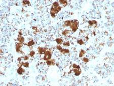 ACTH Antibody - IHC testing of FFPE human pituitary gland with ACTH antibody (clone SPM501). Required HIER: steam sections in 10mM citrate buffer, pH6, for 10-20 min.