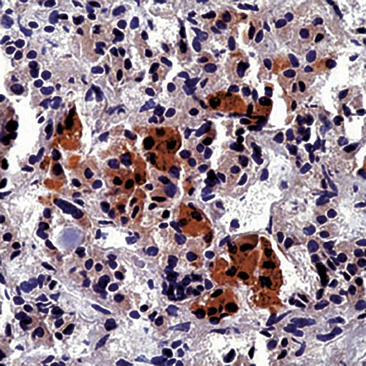 ACTH Antibody - Formalin-fixed, paraffin-embedded human pituitary stained with ACTH antibody.
