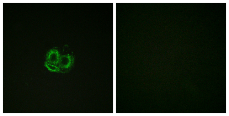 Actin Antibody - Immunofluorescence analysis of HUVEC cells, using Actin-pan Antibody. The picture on the right is blocked with the synthesized peptide.