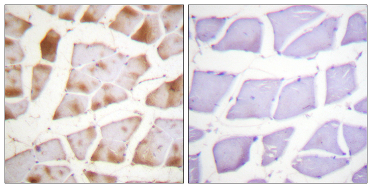Actin Antibody - Immunohistochemistry analysis of paraffin-embedded human skeletal muscle tissue, using Actin-pan Antibody. The picture on the right is blocked with the synthesized peptide.