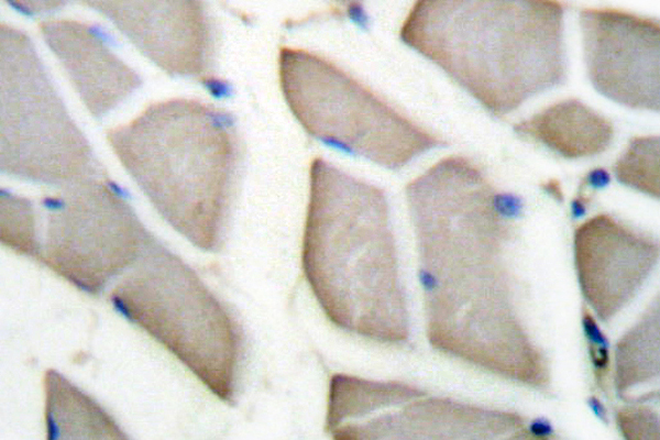 Actin Antibody - IHC of Actin (E361) pAb in paraffin-embedded human skeletal l muscle tissue.