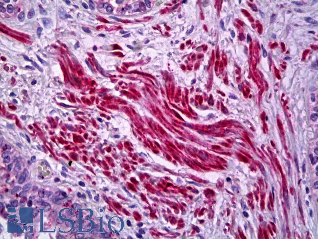 Actin Antibody - Human Prostate, Smooth Muscle: Formalin-Fixed, Paraffin-Embedded (FFPE)