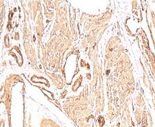 Actin Antibody - Smooth muscle actin antibody Immunohistochemistry.  This image was taken for the unmodified form of this product. Other forms have not been tested.
