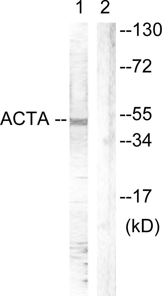 Actin Antibody - Western blot analysis of extracts from mouse brain cells, using Actin-pan (a/ß/?) (Ab-53/55) antibody.