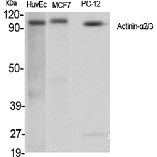 Actinin-Alpha 2+3 Antibody - Western blot of Actinin-alpha2/3 antibody