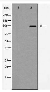 Actinin-Alpha 2+3 Antibody - Western blot of Actinin alpha 2/3 expression in HeLa cells