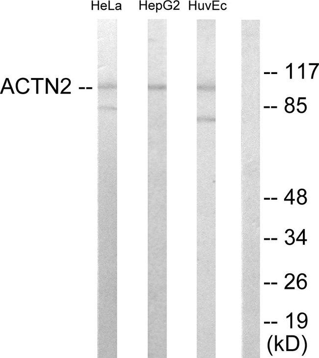 Actinin-Alpha 2+3 Antibody - Western blot analysis of extracts from HeLa cells, HepG2 cells and HUVEC cells, using Actin a-2/3 antibody.