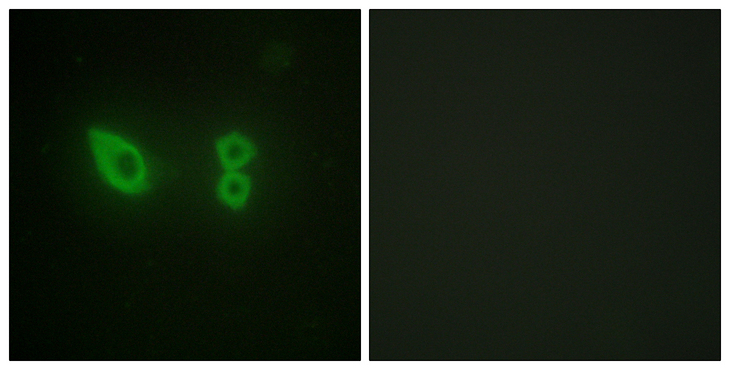 Actinin-Alpha 2+3 Antibody - Immunofluorescence analysis of HeLa cells, using Actinin alpha-2/3 Antibody. The picture on the right is blocked with the synthesized peptide.
