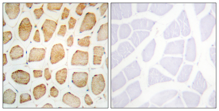 Actinin-Alpha 2+3 Antibody - Immunohistochemistry analysis of paraffin-embedded human skeletal muscle tissue, using Actinin alpha-2/3 Antibody. The picture on the right is blocked with the synthesized peptide.