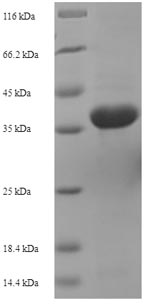 aac Protein - (Tris-Glycine gel) Discontinuous SDS-PAGE (reduced) with 5% enrichment gel and 15% separation gel.