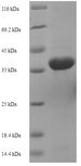 aac Protein - (Tris-Glycine gel) Discontinuous SDS-PAGE (reduced) with 5% enrichment gel and 15% separation gel.