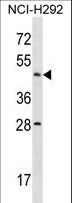 ACTL7B Antibody - ACTL7B Antibody western blot of NCI-H292 cell line lysates (35 ug/lane). The ACTL7B antibody detected the ACTL7B protein (arrow).
