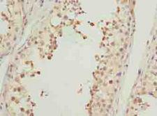 ACTL7B Antibody - Immunohistochemistry of paraffin-embedded human testis tissue using antibody at dilution of 1:100.