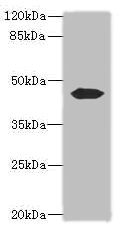 ACTL7B Antibody - Western blot All lanes: ACTL7B antibody at 0.2µg/ml + Mouse gonadal tissue Secondary Goat polyclonal to rabbit IgG at 1/10000 dilution Predicted band size: 45 kDa Observed band size: 45 kDa