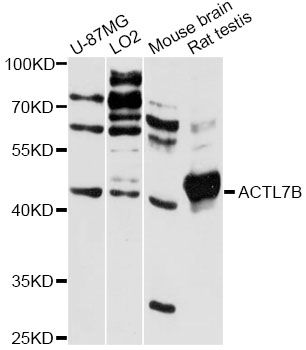 ACTL7B Antibody - Western blot analysis of extracts of various cell lines, using ACTL7B antibody at 1:3000 dilution. The secondary antibody used was an HRP Goat Anti-Rabbit IgG (H+L) at 1:10000 dilution. Lysates were loaded 25ug per lane and 3% nonfat dry milk in TBST was used for blocking. An ECL Kit was used for detection and the exposure time was 60s.