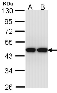 ACTL8 Antibody - Sample (30 ug of whole cell lysate). A: Hep G2 , B: Molt-4 . 10% SDS PAGE. ACTL8 antibody diluted at 1:1000.