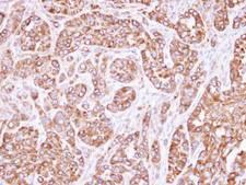 ACTL8 Antibody - IHC of paraffin-embedded A549 xenograft using ACTL8 antibody at 1:500 dilution.