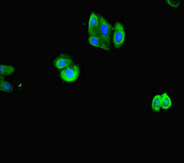 ACTL9 Antibody - Immunofluorescent analysis of HepG-2 cells diluted at 1:100 and Alexa Fluor 488-congugated AffiniPure Goat Anti-Rabbit IgG(H+L)