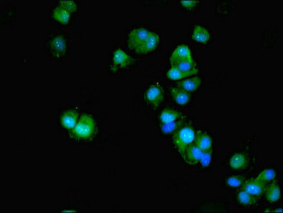ACTL9 Antibody - Immunofluorescent analysis of MCF-7 cells diluted at 1:100 and Alexa Fluor 488-congugated AffiniPure Goat Anti-Rabbit IgG(H+L)