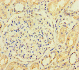 ACTL9 Antibody - Immunohistochemistry of paraffin-embedded human kidney tissue at dilution of 1:100