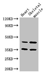 ACTL9 Antibody - Western Blot Positive WB detected in:Mouse heart tissue,Mouse skeletal muscle tissue All Lanes: ACTL9 antibody at 3.25ug/ml Secondary Goat polyclonal to rabbit IgG at 1/50000 dilution Predicted band size: 46 kDa Observed band size: 46,35 kDa