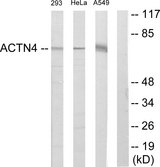 ACTN1+2+3+4 Antibody - Western blot analysis of lysates from 293, HeLa, and A549 cells, using ACTN1/2/3/4 Antibody. The lane on the right is blocked with the synthesized peptide.