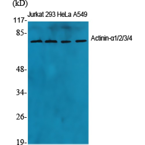 ACTN1 Antibody - Western blot of Actinin-alpha1/2/3/4 antibody