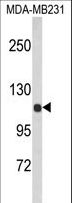 ACTN1 Antibody - Western blot of ACTN1 Antibody in MDA-MB231 cell line lysates (35 ug/lane). ACTN1 (arrow) was detected using the purified antibody.