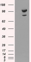 ACTN1 Antibody - HEK293T cells were transfected with the pCMV6-ENTRY control (Left lane) or pCMV6-ENTRY ACTN1 (Right lane) cDNA for 48 hrs and lysed. Equivalent amounts of cell lysates (5 ug per lane) were separated by SDS-PAGE and immunoblotted with anti-ACTN1.