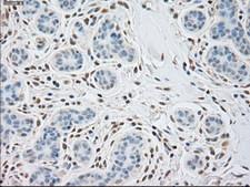 ACTN1 Antibody - IHC of paraffin-embedded Human breast tissue using anti-ACTN1 mouse monoclonal antibody.