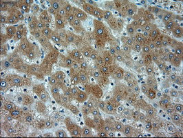 ACTN1 Antibody - IHC of paraffin-embedded Human liver tissue using anti-ACTN1 mouse monoclonal antibody.