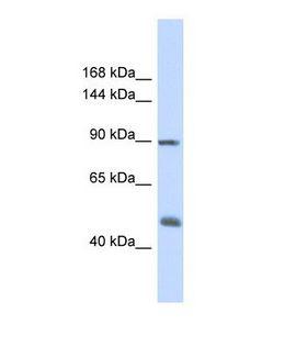 ACTN1 Antibody - Western blot of Human Fetal Muscle. ACTN1 antibody dilution 1.0 ug/ml.  This image was taken for the unconjugated form of this product. Other forms have not been tested.