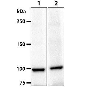 ACTN1 Antibody - The cell lysates (40ug) were resolved by SDS-PAGE, transferred to PVDF membrane and probed with anti-human ACTN1 antibody (1:1000). Proteins were visualized using a goat anti-mouse secondary antibody conjugated to HRP and an ECL detection system. Lane 1. : PC-3 cell lysate Lane 2. : A549 cell lysate